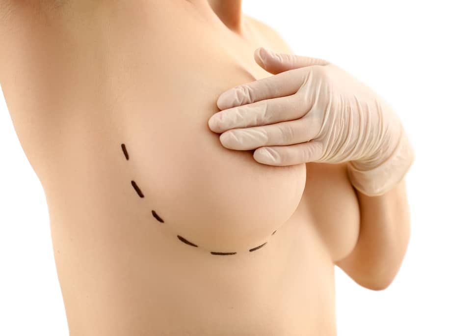 The Perfect Sideboob Look for Women with Large Breasts - Atlanta  Liposuction Specialty Clinic